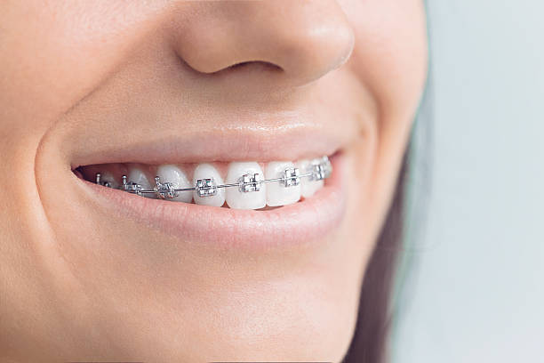 Best Traditional Braces  in Coplay, PA